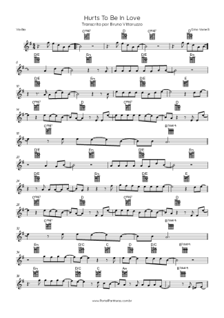 Gino Vannelli Hurts To Be In Love score for Acoustic Guitar